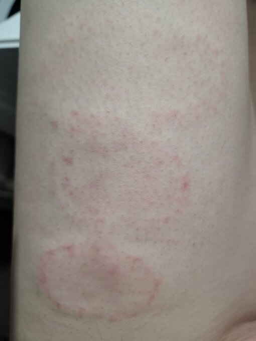 YUMA（ユマ） トリプル