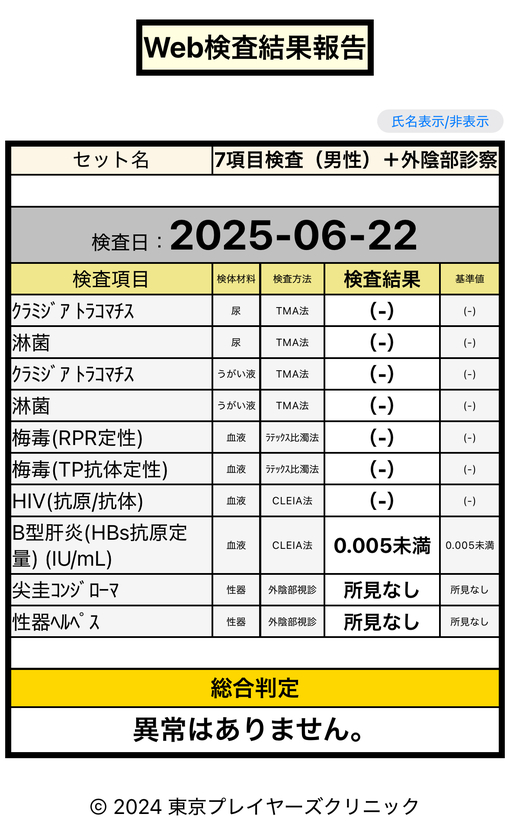 HOKUTO(ホクト) 6月定期検査報告