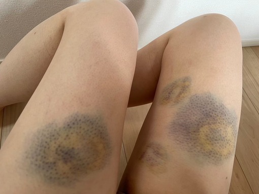 YUNO(ユノ) 一石三鳥🪨🦢🦢🦢