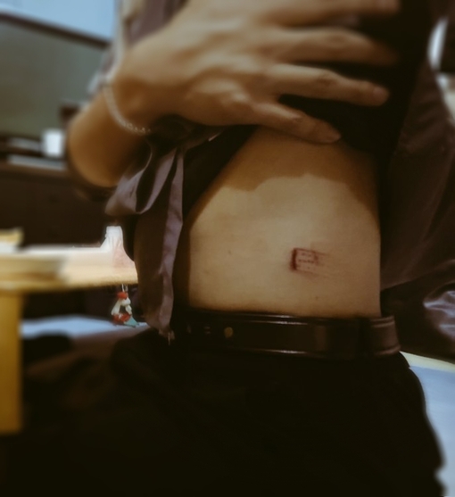 YUMA（ユマ） 1本鞭で打たれると…