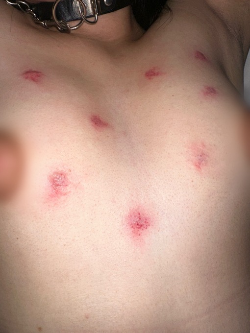 TORI（トウリ） キスマ