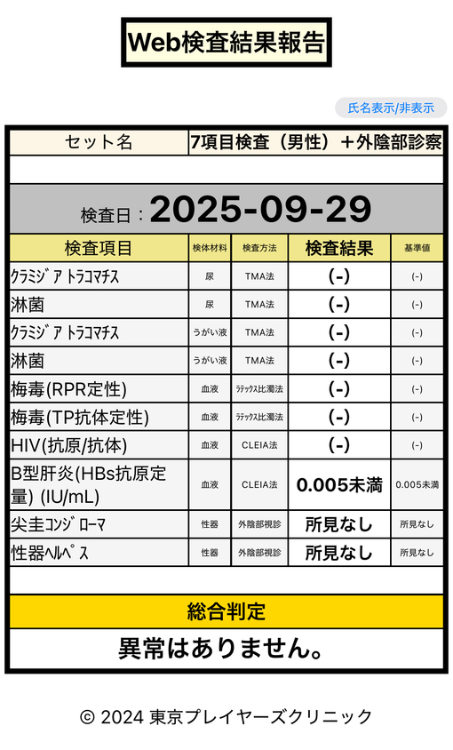 HOKUTO(ホクト) 9月定期検査報告