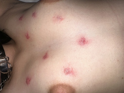 TORI（トウリ） ガッツリキスマーク