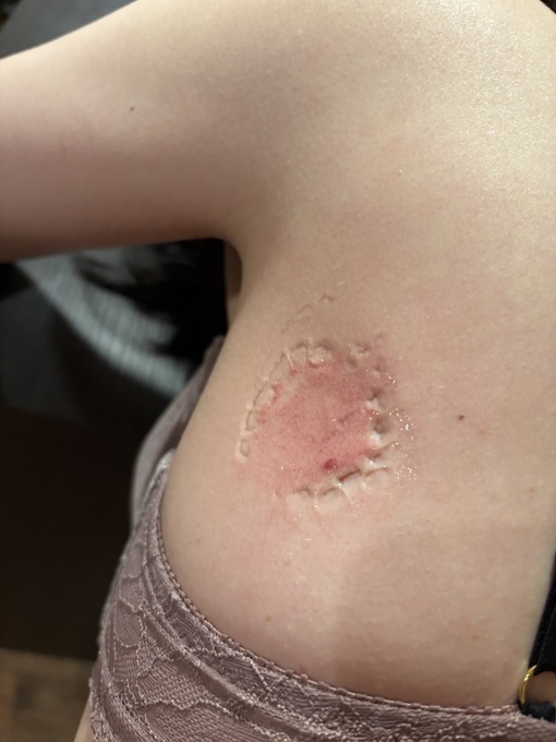 MAKOTO（マコト） 噛み跡の楽しみ方vol.0