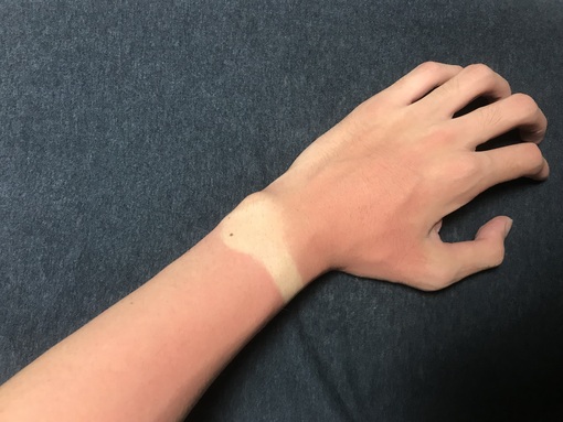 TSUMUGI（ツムギ） 日焼け対策☀️